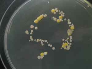 Biology Bacteria Agar Plate Experiment