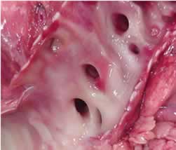 A tracheole is cut open revealing the rings of cartilage that support it. Note how this tracheole divides even further into smaller and smaller tubes. Click to see a 120kb movie of the millions of alveoli inflating in a real lung.
