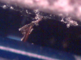 The razor blade viewed at 60X magnification. Skin and hair can be seen.