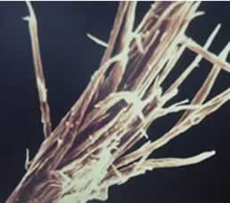 A microscopic view of a hair fibre with split ends. Magnification 400X